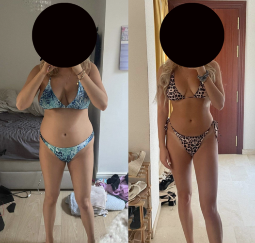 woman in bikini before and after picture